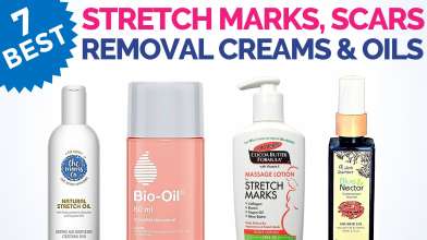 7 Best Stretch Marks Removal Creams and Oils in India with Price